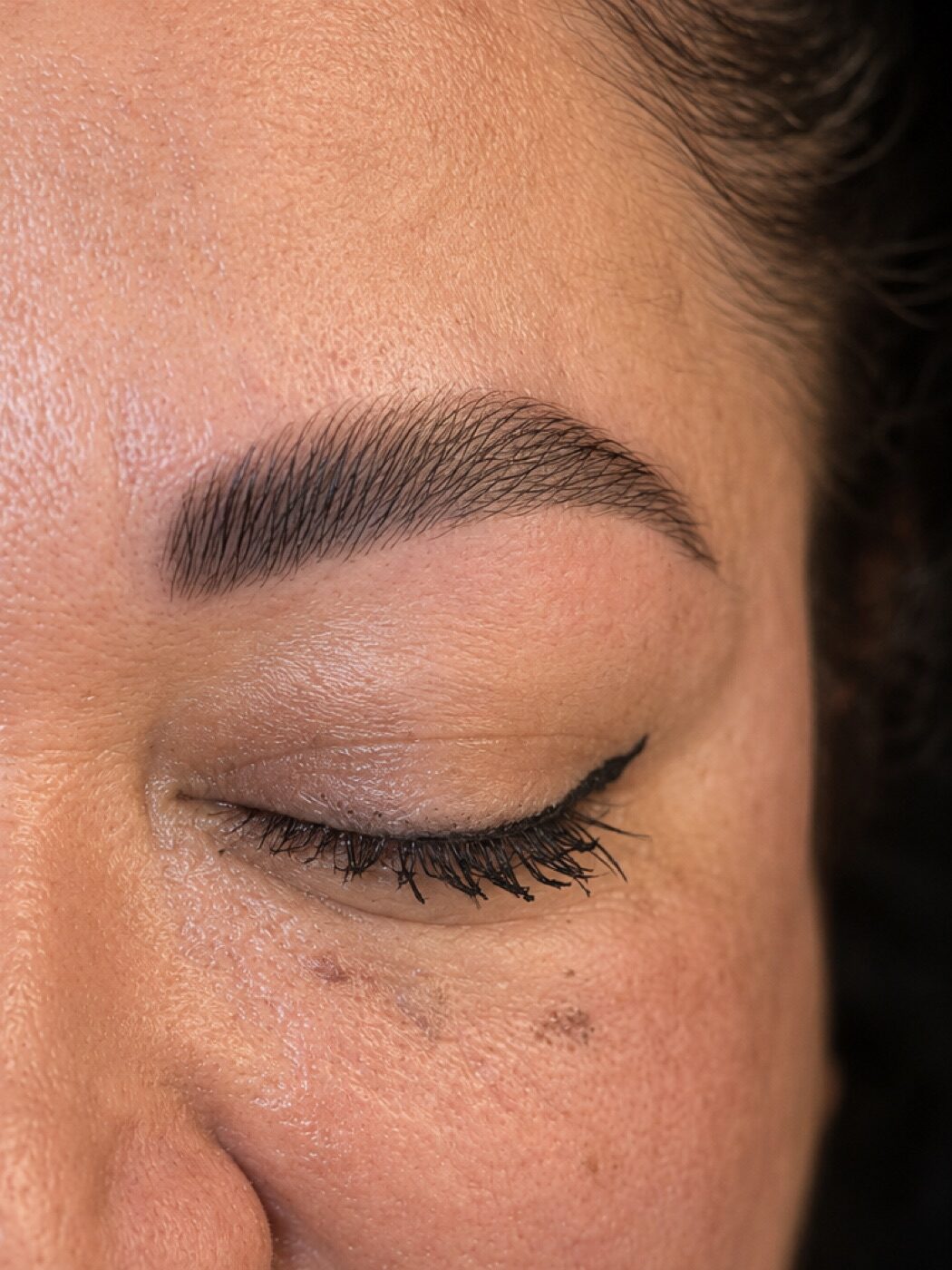 Sourcil discipliné et structuré après un brow lift, poils peignés vers le haut